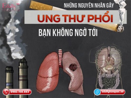 Những Nguyên Nhân Gây Ung Thư Phổi Mà Bạn Không Ngờ Tới