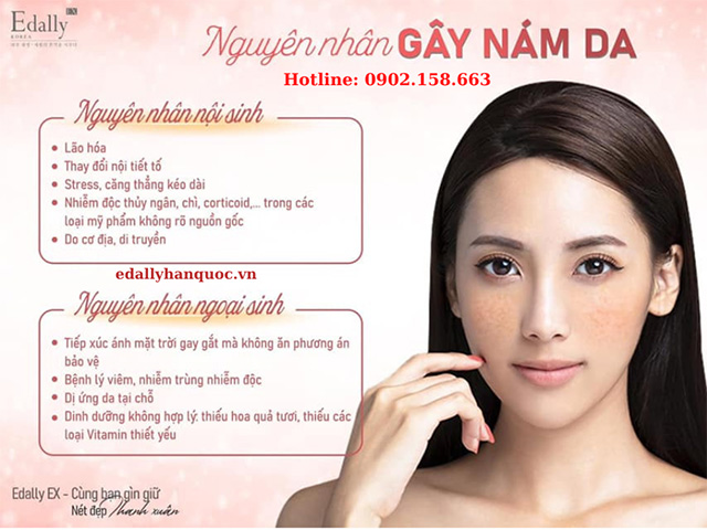 Những nguyên nhân gây nám da mặt