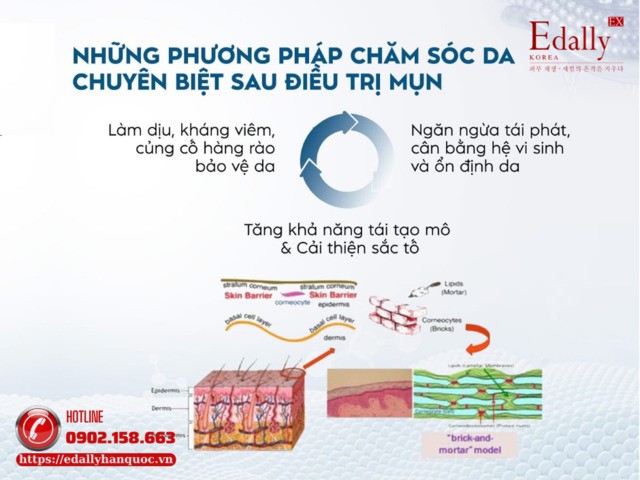 Các phương pháp chăm sóc da chuyên biệt sau điều trị mụn