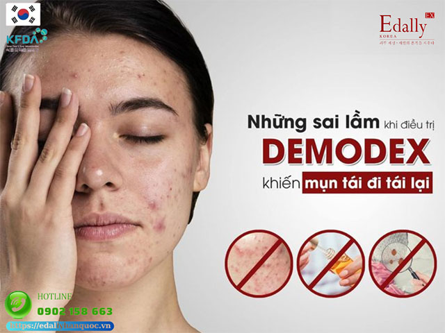 Những sai lầm khi điều trị demodex khiến mụn tái đi tái lại nhiều lần