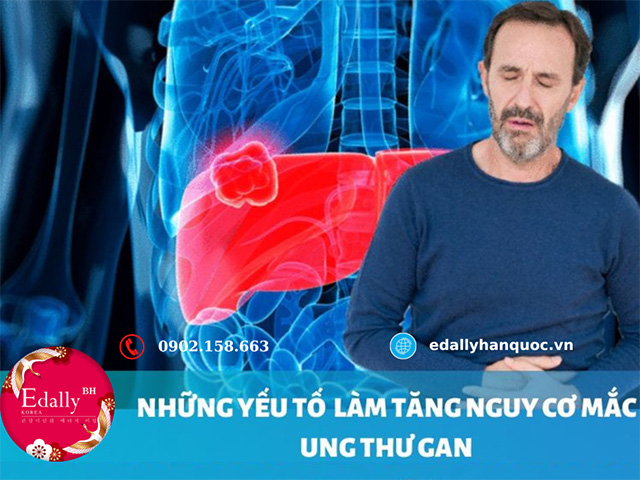 Những Nguyên Nhân Làm Tăng Nguy Cơ Mắc Bệnh Ung Thư Gan