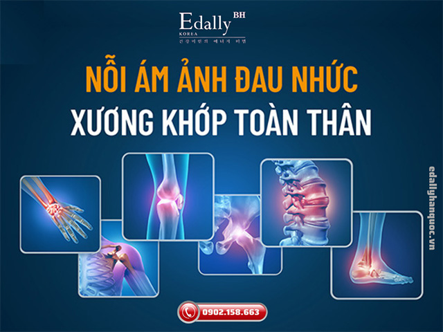 Nỗi ám ảnh của bệnh đau nhức xương khớp toàn thân