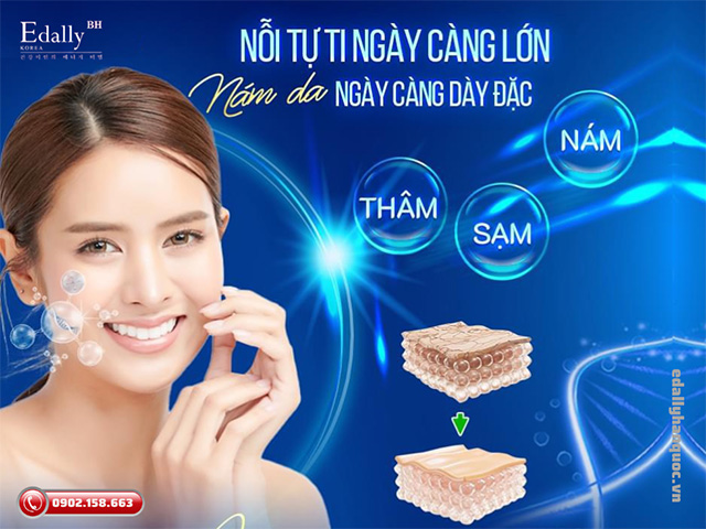 Nỗi tự ti ngày càng lớn, nám da ngày càng dày đặc