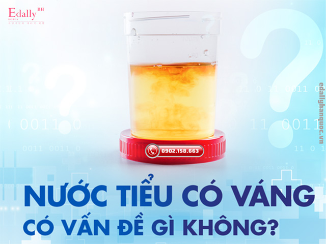 Nước tiểu có váng như váng mỡ có vấn đề gì không?