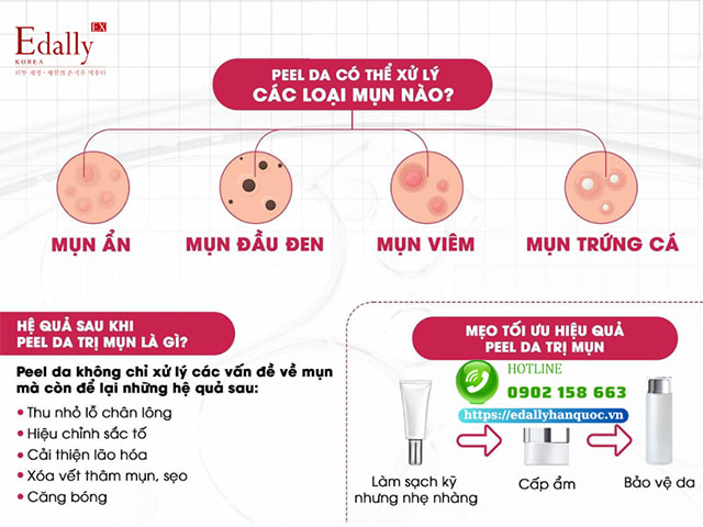 Peel da có thể xử lý các loại mụn nào?