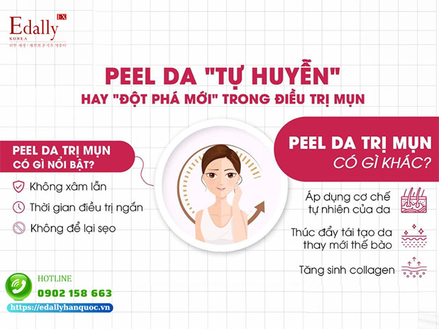 Peel da - Tự huyễn hay đột phá mới trong điều trị mụn trứng cá