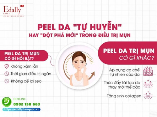 Peel Da - Tự Huyễn Hay Đột Phá Mới Trong Điều Trị Mụn