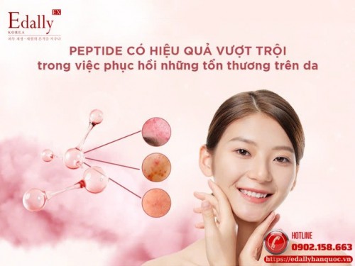 Tổng Hợp Các Câu Hỏi Về Peptide Được Quan Tâm Nhiều Nhất 