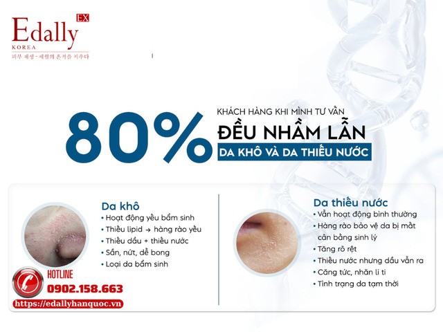 Phân Biệt Da Khô Với Da Thiếu Nước Và Cách Chăm Sóc