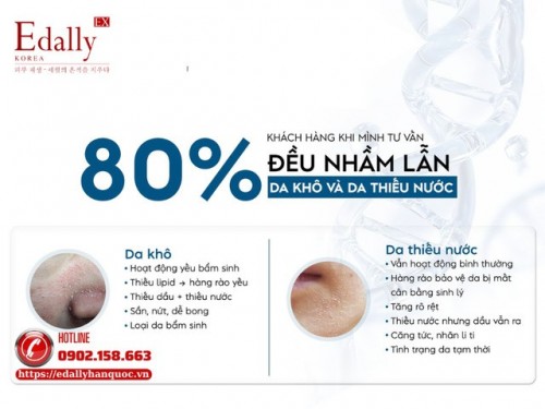 Phân Biệt Da Khô Với Da Thiếu Nước Và Cách Chăm Sóc