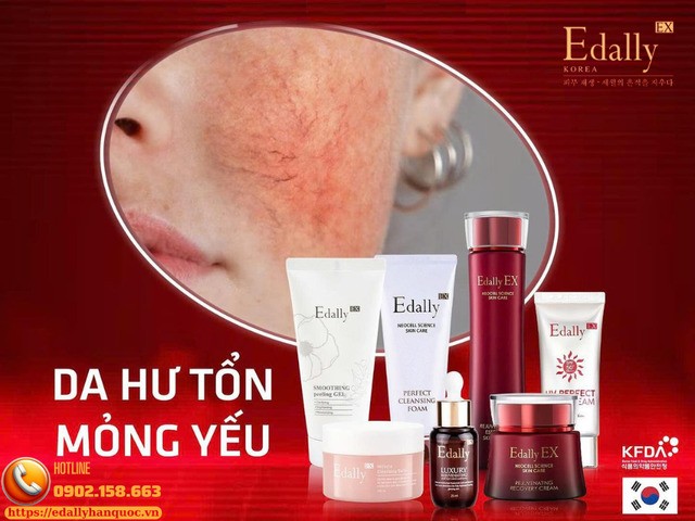 Combo cai nghiện và phục hồi da bị nhiễm corticoid