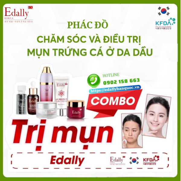 Routine trị mụn trứng cá trên da dầu tại nhà hiệu quả