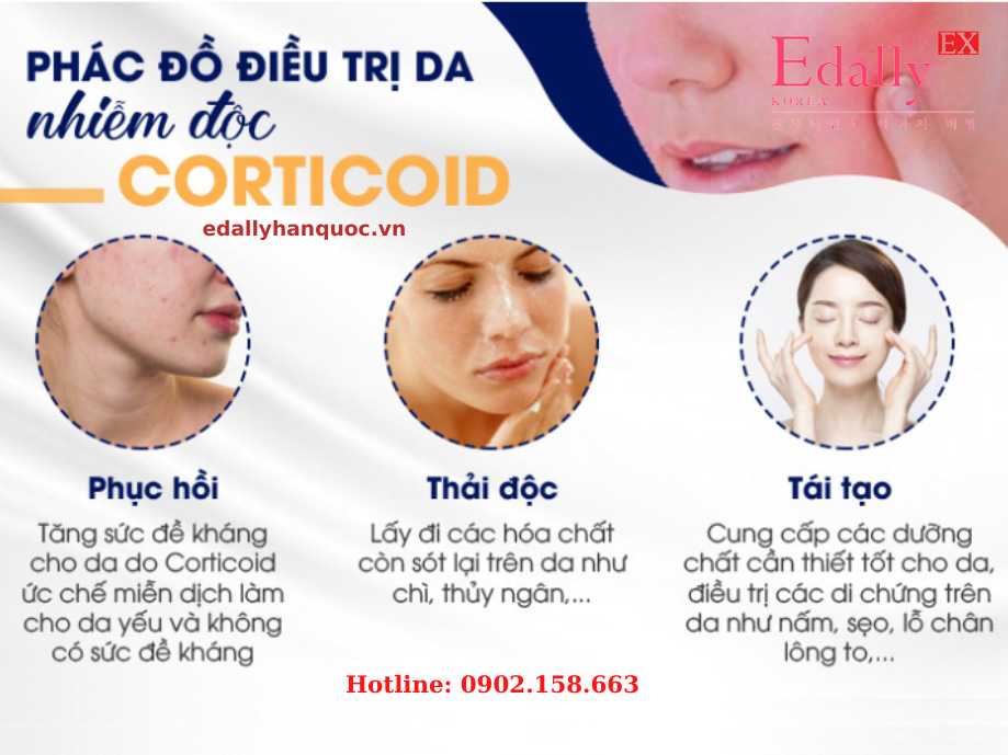 Phác đồ điều trị và phục hồi cho làn da bị nhiễm độc Corticoid