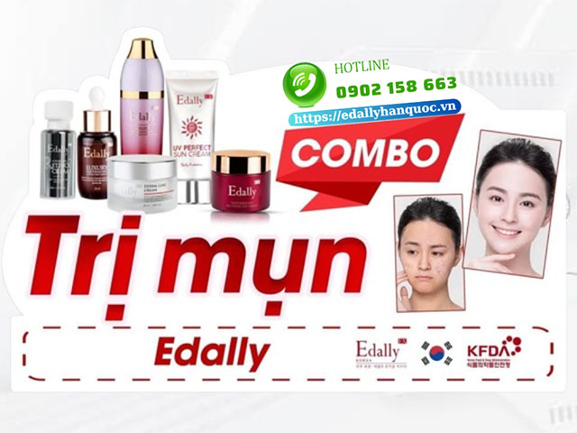 Phác đồ trị mụn hiệu quả tại nhà để mụn không quay trở lại