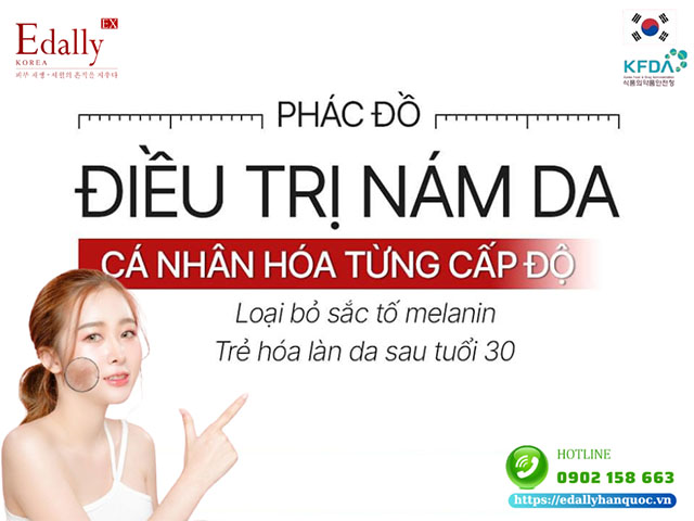 Phác đồ điều trị nám da cá nhân hóa cho từng cấp độ nám