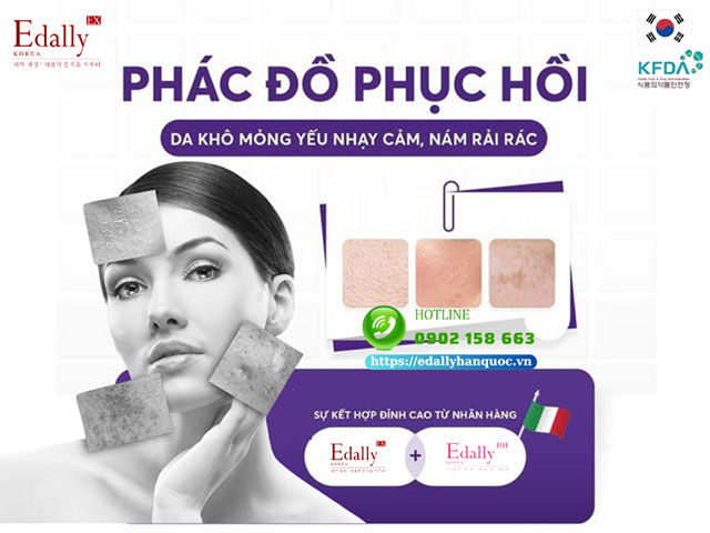 Phác đồ tiêu biểu phục hồi da khô mỏng yếu nhạy cảm, nám rải rác