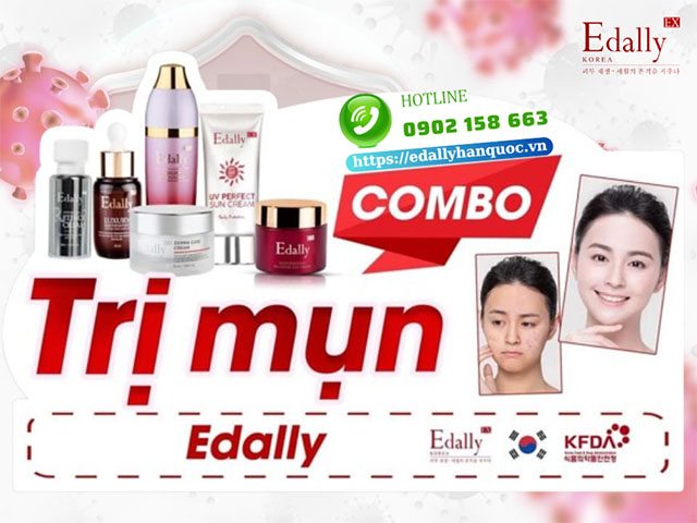 Phác đồ trị mụn trứng cá trên nền da yếu Edally EX