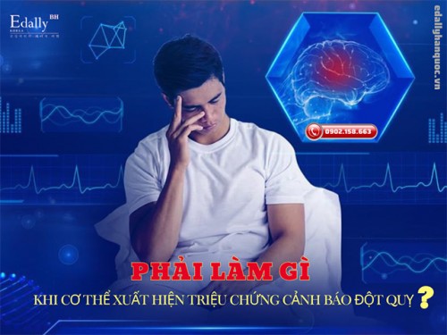 Làm Gì Khi Cơ Thể Xuất Hiện Dấu Hiệu Sắp Bị Đột Quỵ Não?