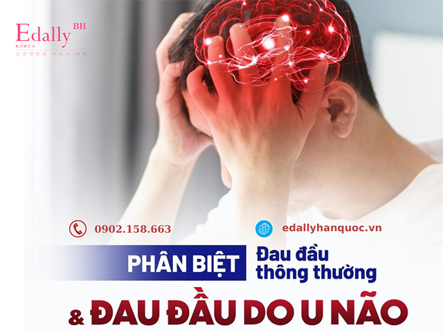 Cách phân biệt đau đầu thông thường và đau đầu do u não