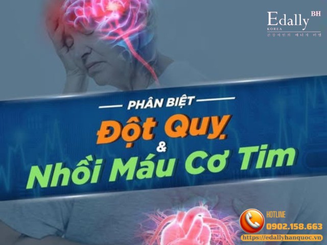 Phân biệt đột quỵ não & nhồi máu cơ tim