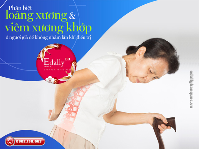 Cách phân biệt loãng xương và viêm xương khớp ở người già để không nhầm lẫn khi điều trị