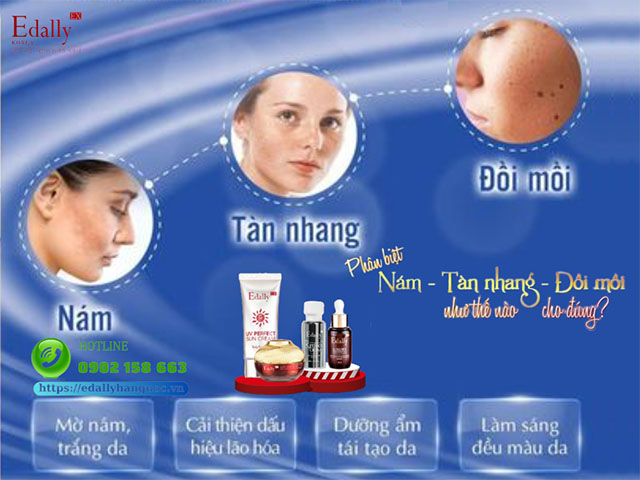 Phân biệt nám, tàn nhang, đồi mồi như thế nào cho đúng?