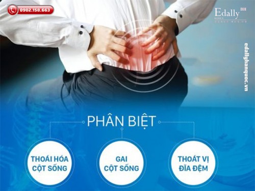 Phân Biệt Thoái Hóa Cột Sống - Gai Cột Sống - Thoát Vị Đĩa Đệm