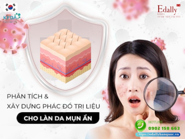 Phân tích da và xây dựng phác đồ homecare điều trị cho làn da mụn ẩn