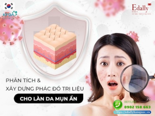 Phân Tích Da Và Xây Dựng Phác Đồ Trị Liệu Cho Làn Da Mụn Ẩn