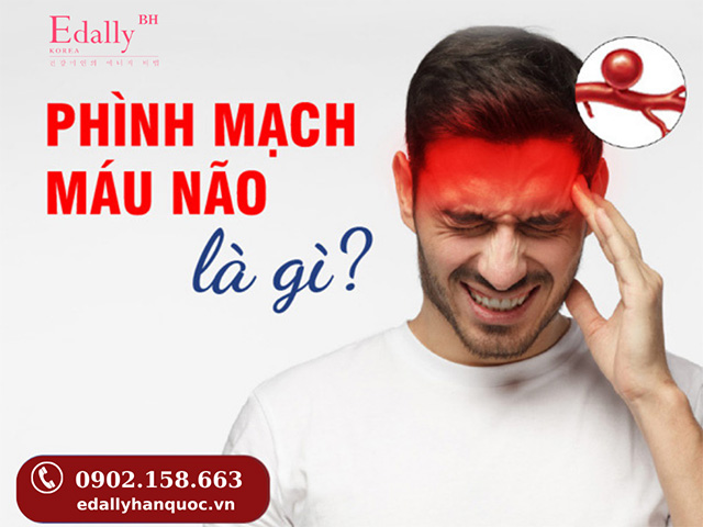 Bệnh phình mạch máu não là gì?