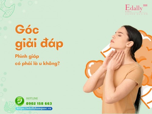 Phình Tuyến Giáp Có Phải U Tuyến Giáp Không?