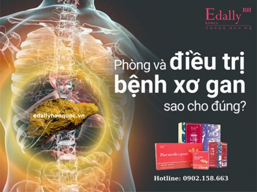 Bệnh Xơ Gan - Nguyên Nhân, Triệu Chứng, Cách Điều Trị Bệnh