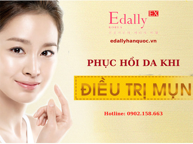 Điều trị mụn rất quan trọng việc phục hồi da