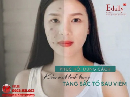 Phục Hồi Đúng Cách - Kiểm Soát Tình Trạng Tăng Sắc Tố Sau Viêm (PIH)