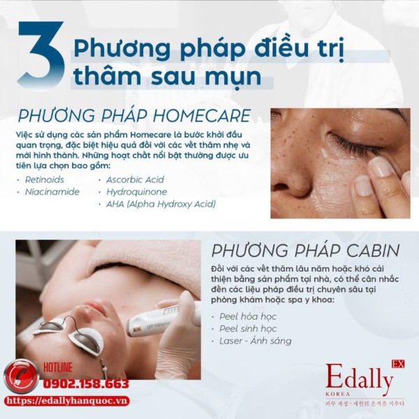 Phương pháp điều trị thâm sau mụn