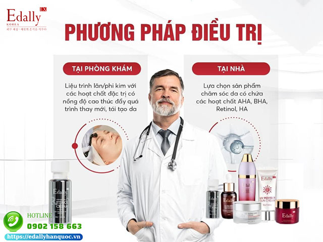 Phương pháp điều trị mụn trứng cá tại nhà an toàn và hiệu quả