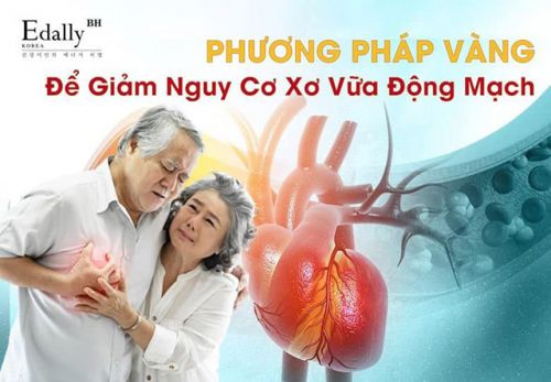 Triệu Chứng Thường Gặp Của Xơ Vữa Động Mạch