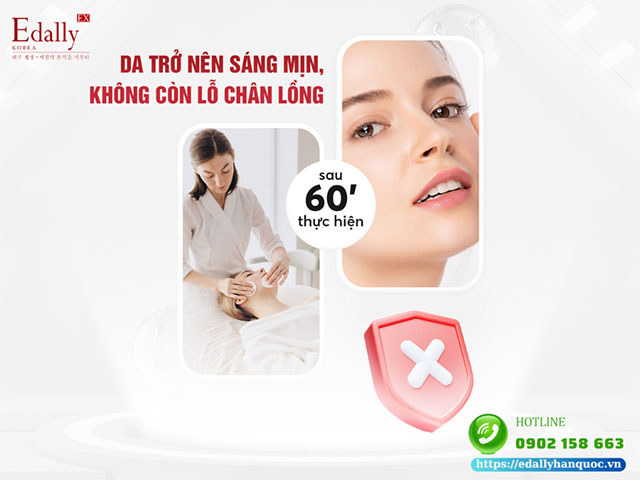 Có phải phương pháp làm đẹp Mesotherapy làm da sáng mịn, không còn lỗ chân lông sau… 60 phút thực hiện?