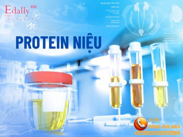 Protein Niệu (Đạm Niệu) - Cách Xác Định Và Ý Nghĩa Bệnh Lý