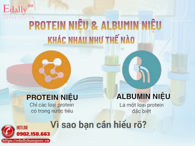 Protein niệu và albumin niệu khác nhau như thế nào và ứng dụng ra sao trong thực hành lâm sàng? Protein niệu và albumin niệu khác nhau như thế nào và ứng dụng ra sao trong thực hành lâm sàng?