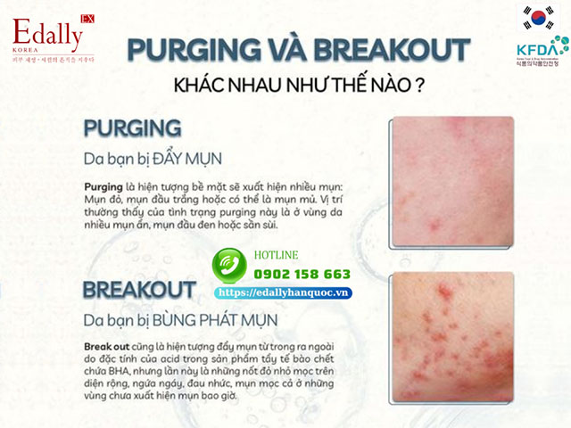 Purging và breakout khác nhau như thế nào?