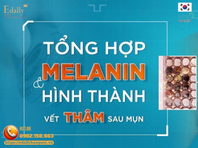 Quá trình tổng hợp melanin và hình thành vết thâm sau mụn