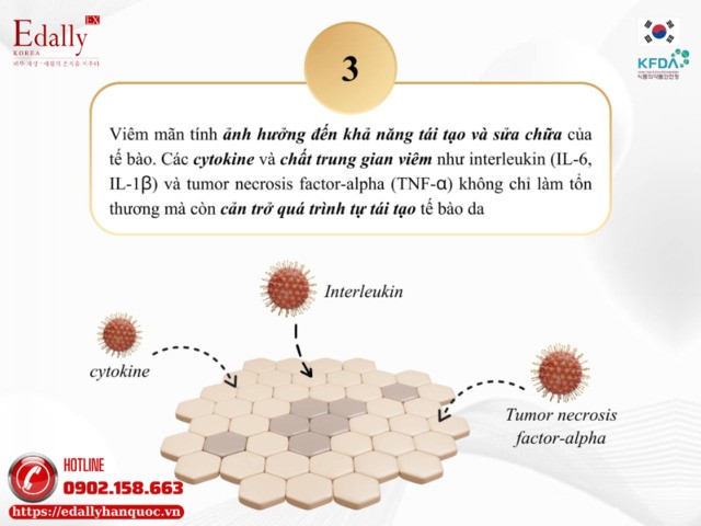 Quá trình viêm gây lão hóa da do viêm làm ảnh hưởng đến khả năng tái tạo và sửa chữa của tế bào