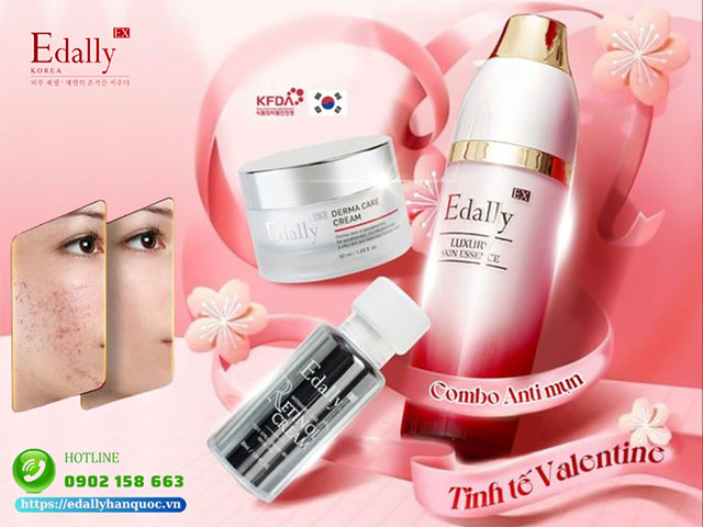 Quà Valentine tặng nàng da xinh với combo anti mụn Edally EX Hàn Quốc