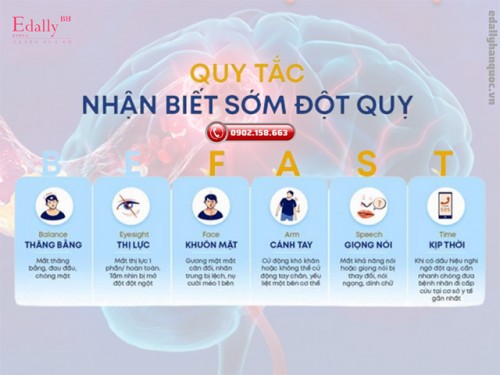 BE FAST - Dấu Hiệu Nhận Biết Sớm Về Đột Quỵ