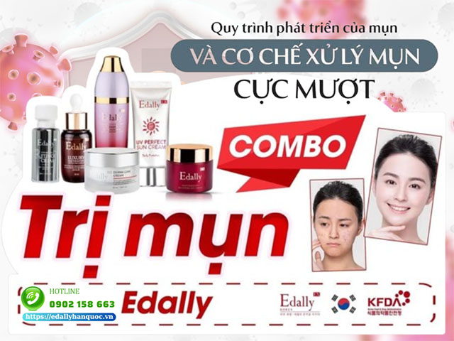 Quy trình phát triển của mụn và cơ chế xử lý mụn cực mượt từ Mỹ phẩm Edally EX Hàn Quốc