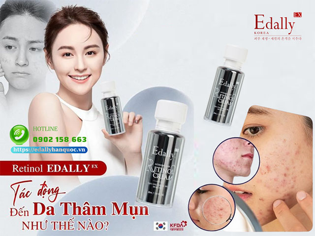 Dùng Retinol để trị mụn được không?