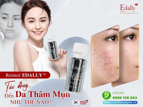 Retinol Edally EX Có Những Yếu Tố Nào Giúp Giảm Thâm, Mụn?