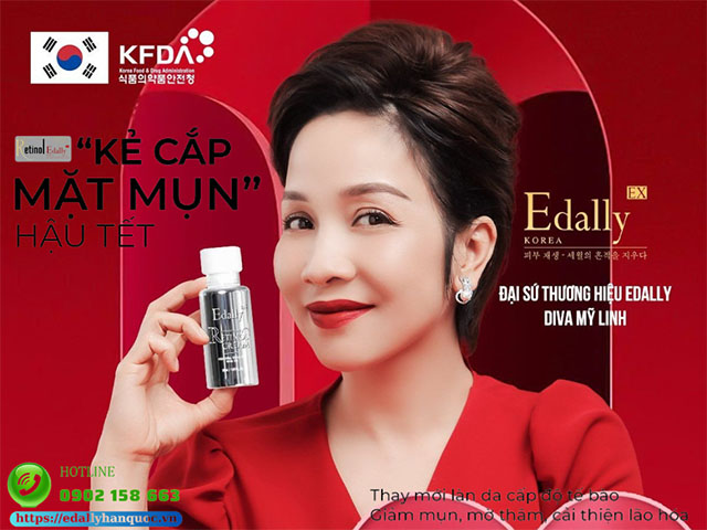 Kem Retinol Edally EX Hàn Quốc - Kẻ đánh cắp mụn hậu tết