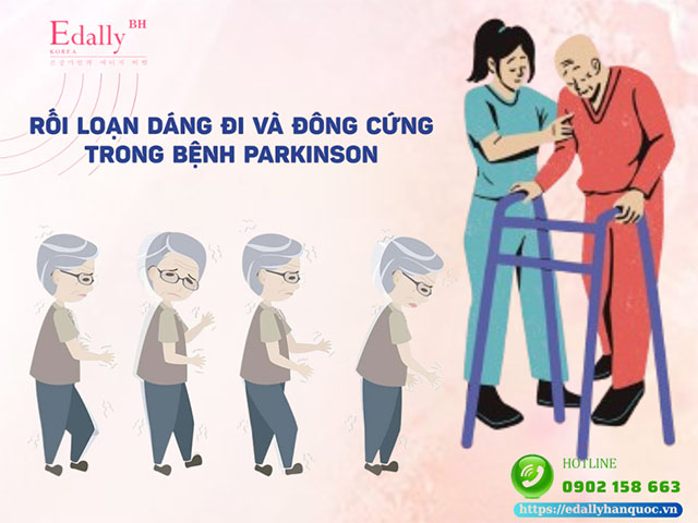 Rối loạn dáng đi và đông cứng dáng đi trong bệnh Parkinson xử lý thế nào?